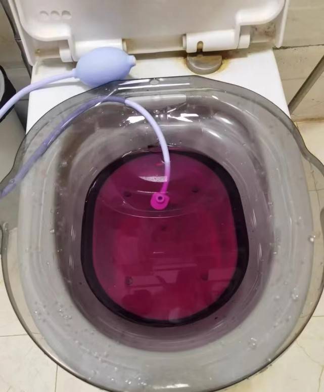高锰酸钾坐浴浓度 来自搜狐网