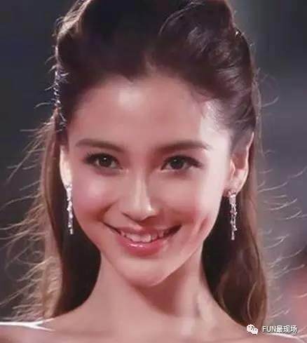 baby整牙前照片曝光,凤姐嘲讽称和自己长得像!_牙齿_林允_林心如