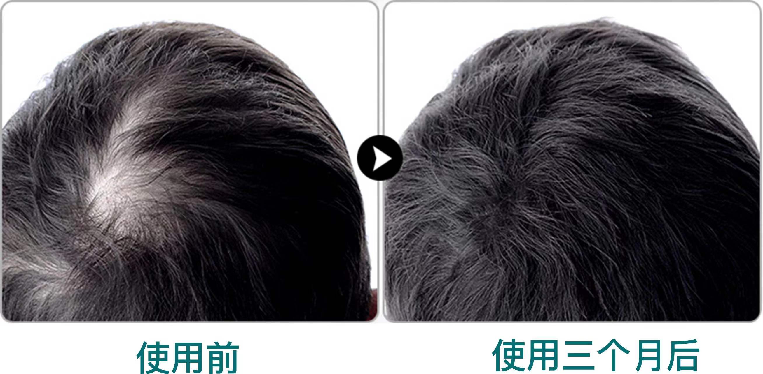男士防脱洗发水前10_时候_味道_效果