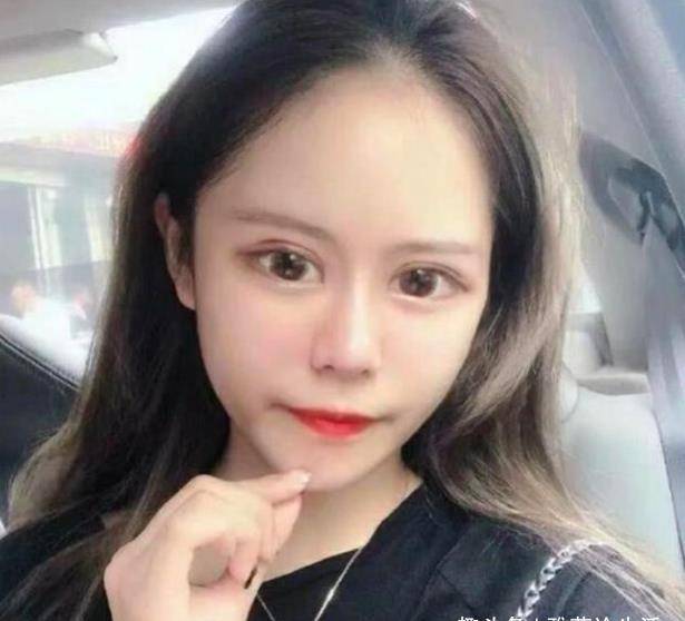 13岁女孩因整容成瘾无法自拔,花100万整容60次,如今成这模样!