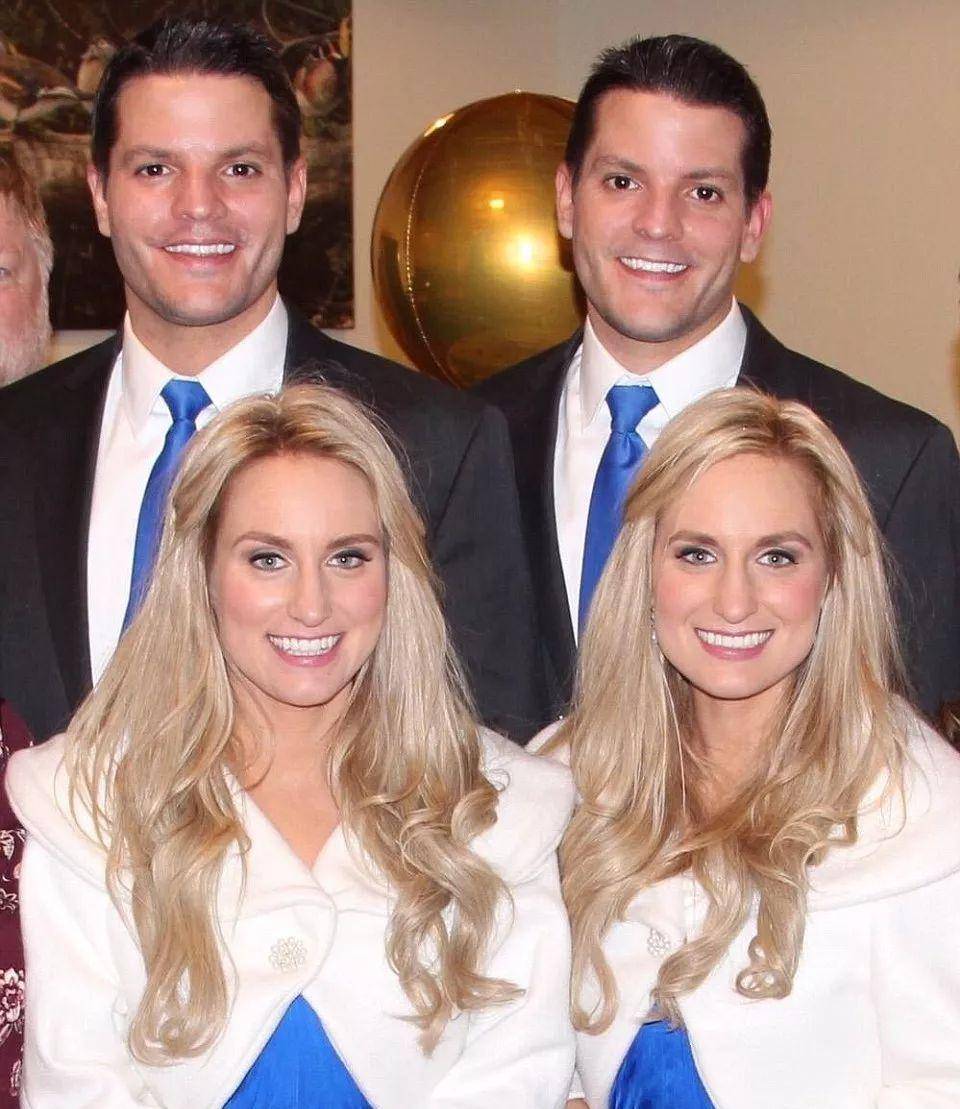 妹妹去世后,连体姐姐被迫跟遗骸共同生活_希尔顿_姐妹_双胞胎