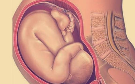 孕期胎位:头先露,肩先露,臀先露有啥不同?