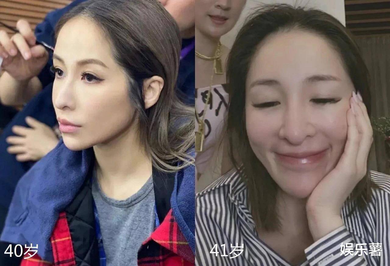 但是萧亚轩也没有责怪自己的爱犬,而是坚持通过手术来改善这种现状,在