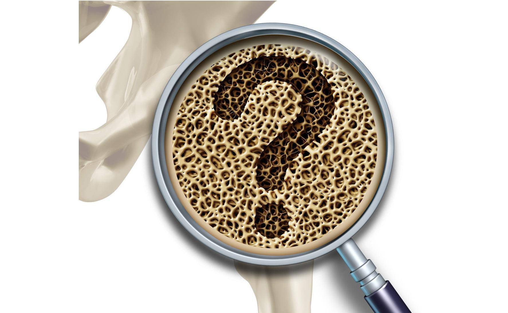 一年只要打一次的"唑来膦酸",是抗骨质疏松神药?