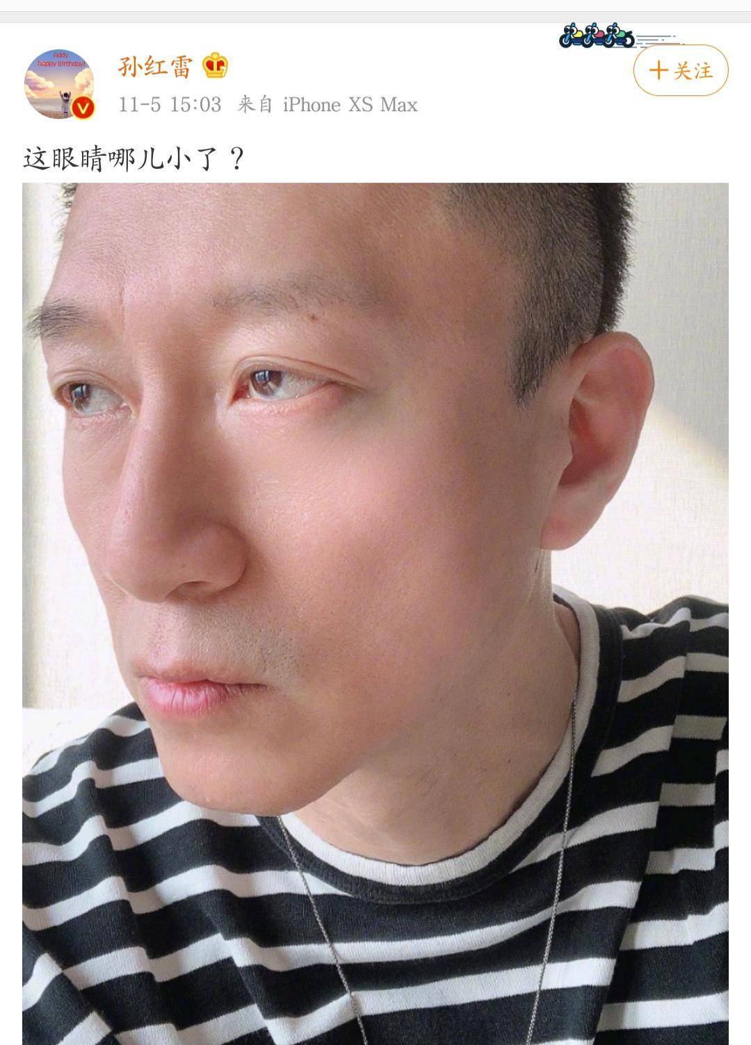 孙红雷晒自拍,问自己眼睛哪里小,为角色减重搭档张艺兴_网友_官宣由