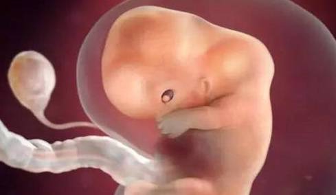 怀孕4周胎儿b超图图片