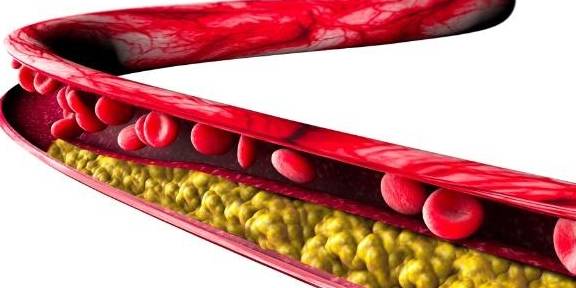 心血管内科医生:它才是高血脂的"罪魁祸首",你还天天吃那么多_粗粮