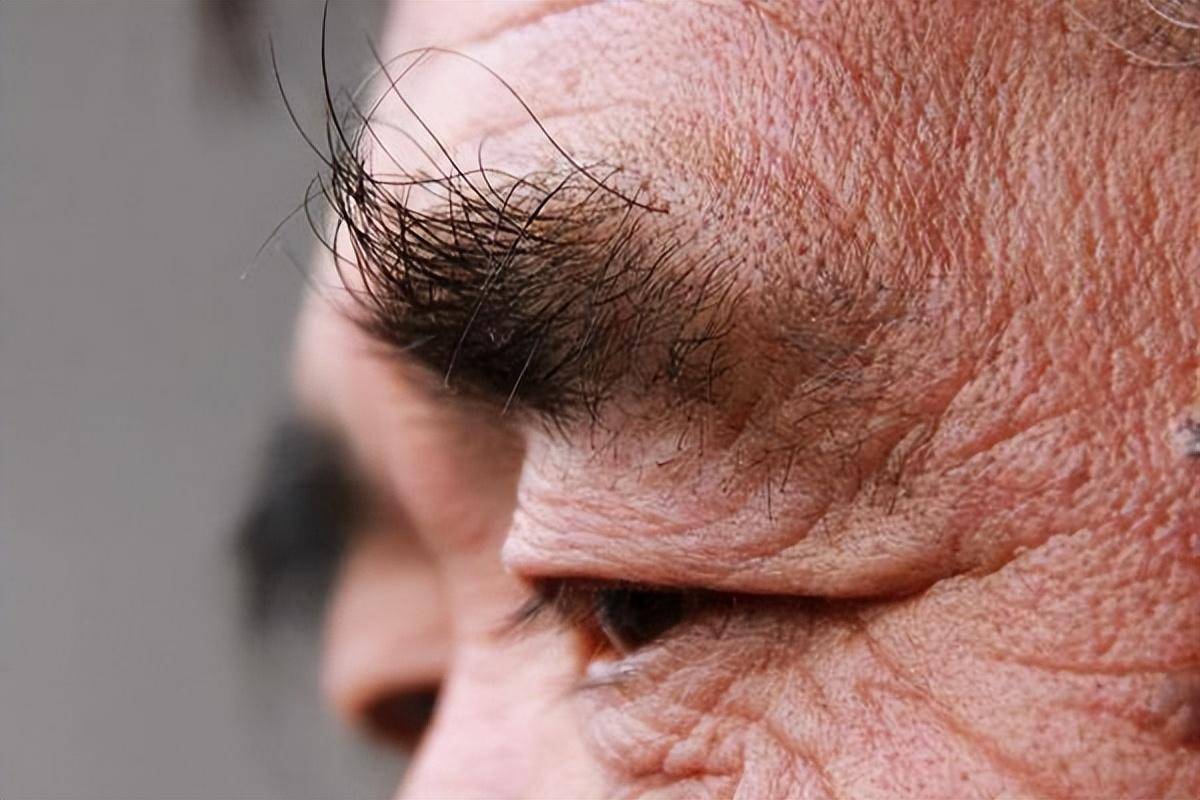 分泌过多50岁以后,男人的眉毛开始变长,这与体内雄性激素分泌旺盛有关