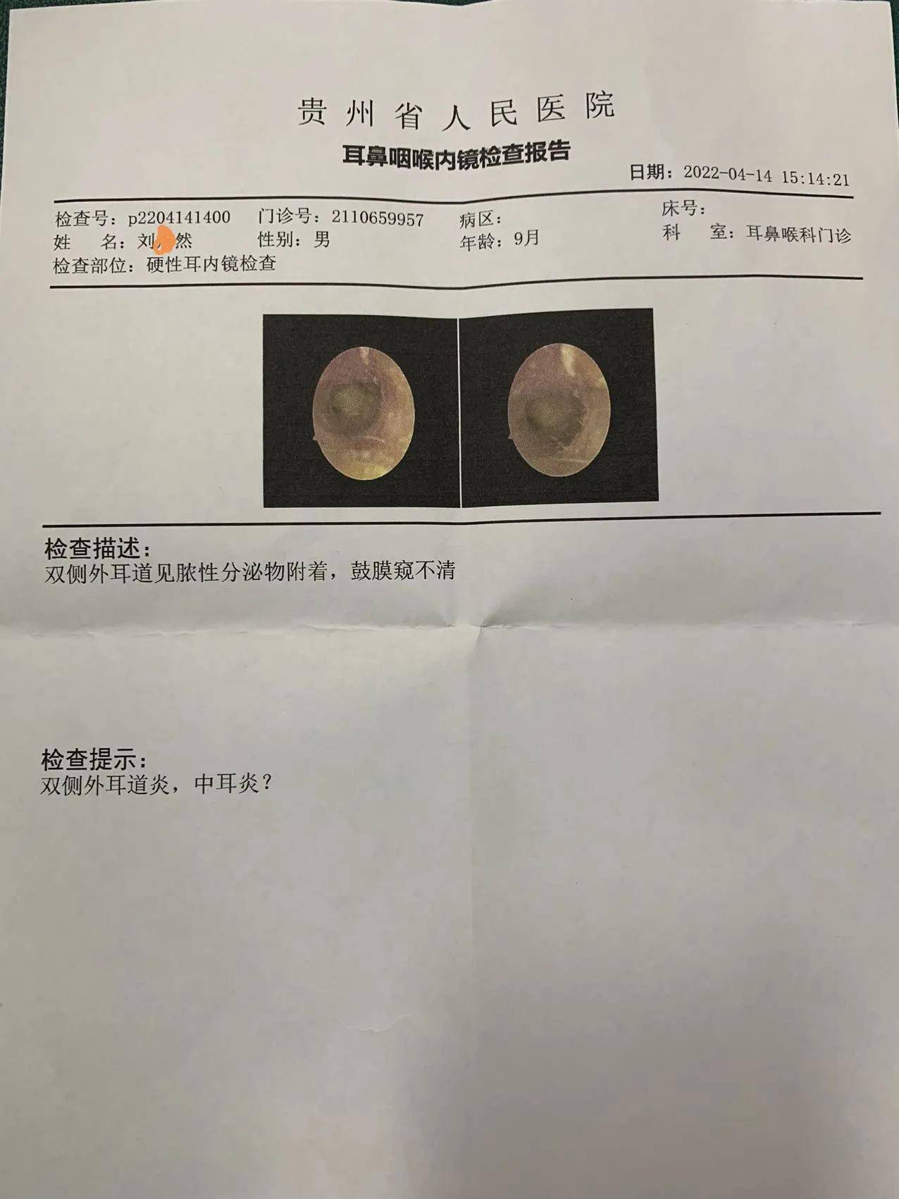 线上问诊也能解决疑难杂症_建议_外耳道_抗生素