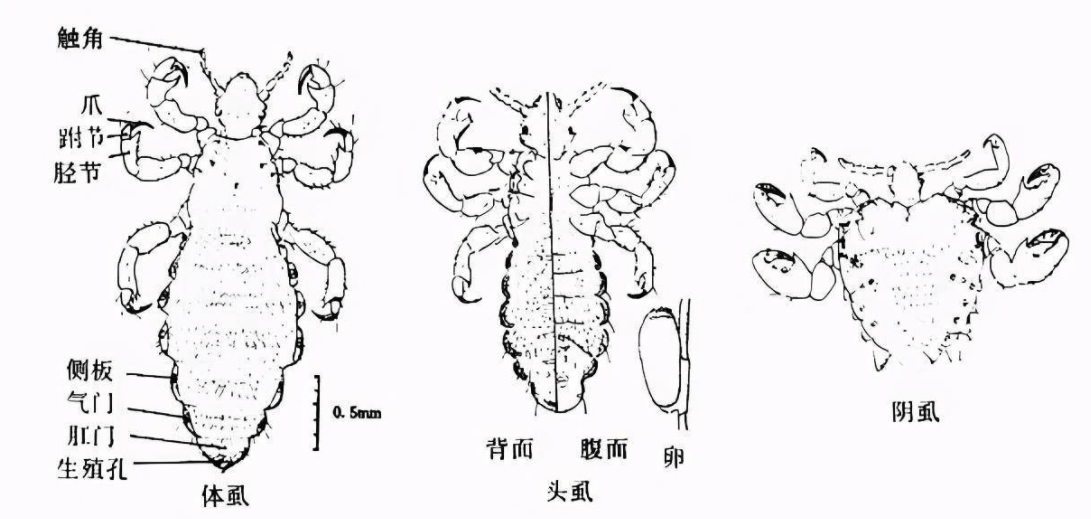 头虱吸血图片