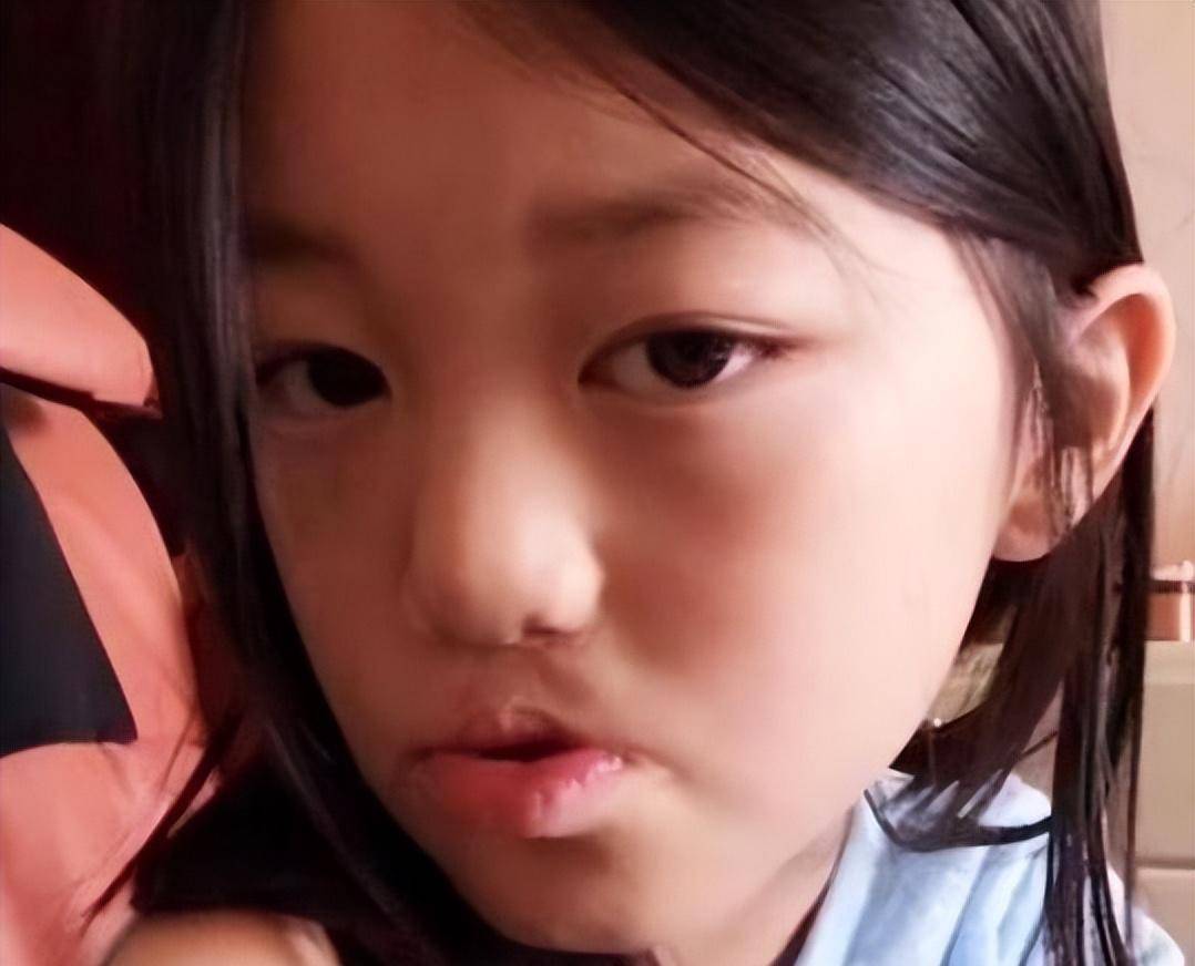 李嫣唇裂,妻子患遗传病,小女儿怕遗传考试不理想_哈金_影响_严重