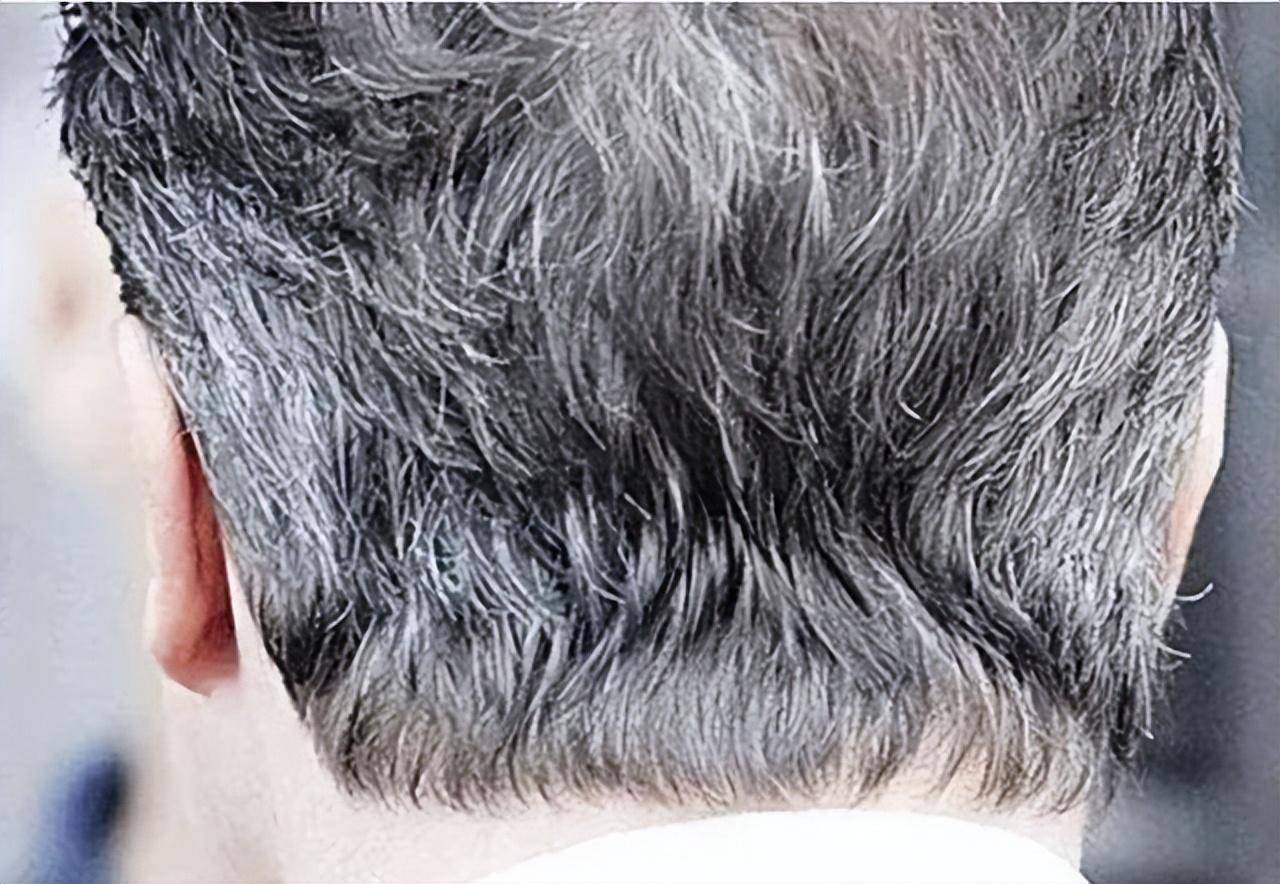 为什么会长白头发?长在两鬓,前额,后脑勺分别代表什么?