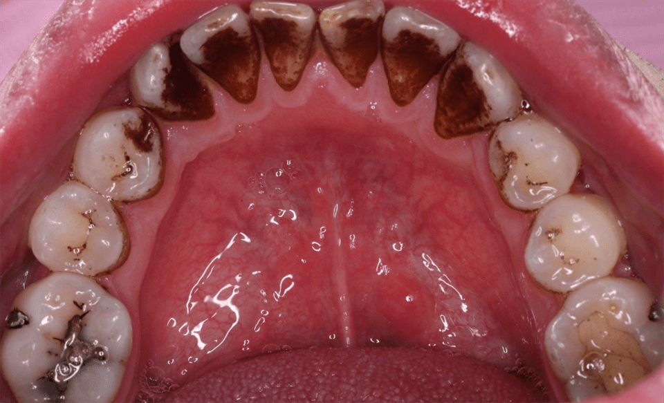 牙齿_朋友_方法