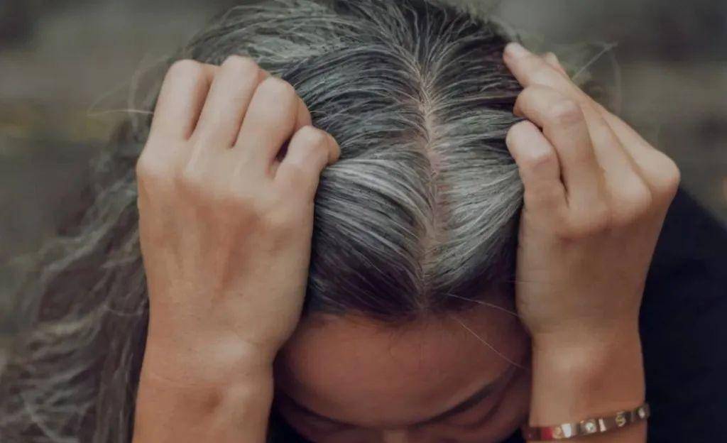 为什么压力大时会长白头发?这些习惯可以控制白发增多!