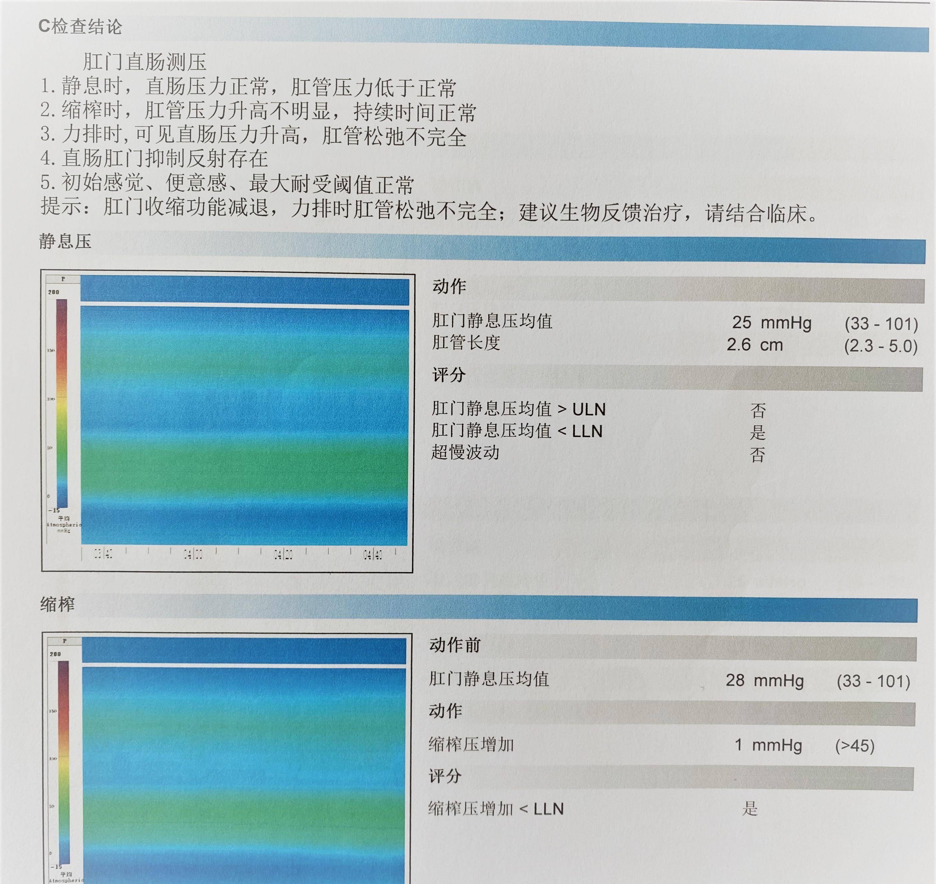 肛门直肠测压报告4  肛门肌电图评价外括约肌和耻骨直肠肌电活动