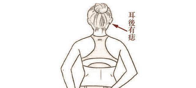 四颗暗钱痣,男女贵,身体健康,富贵长寿!_财富_臀部_生活