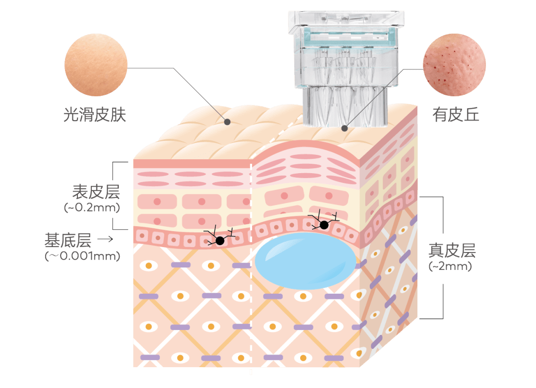 护理_疗法_层次