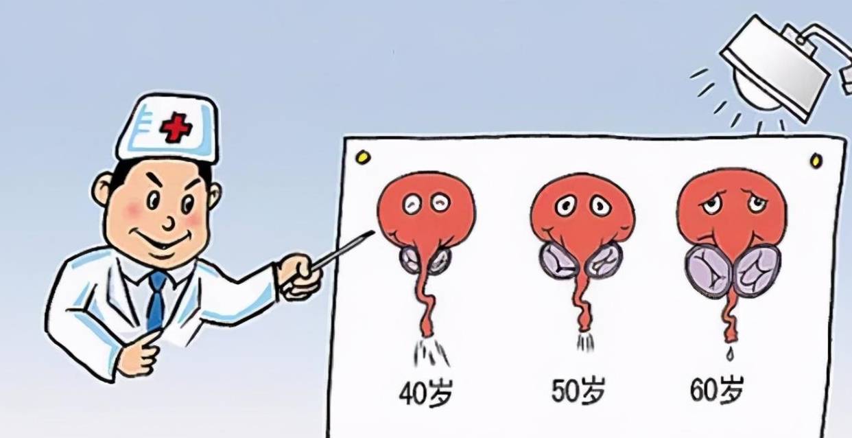 前列腺癌这个"心机boy"的"腹黑上位"史_患者_男性_发病率