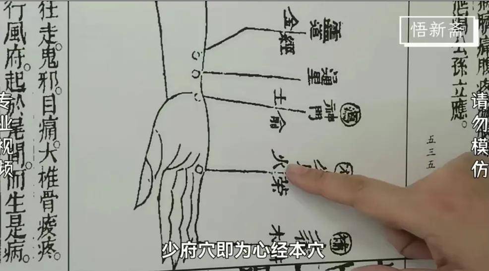 實則瀉其子針刺少府穴採用平補平瀉針刺神門穴採用瀉法以上就是子午流