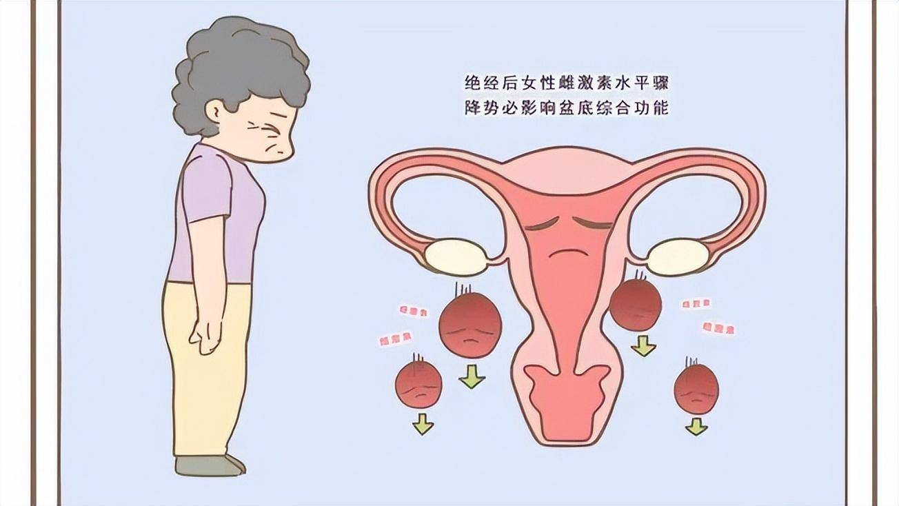 由于女性卵巢功能衰退,雌性激素水平分泌减少,这可能会导致女性阴道