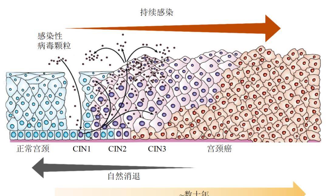 宫颈组织学分层示意图图片