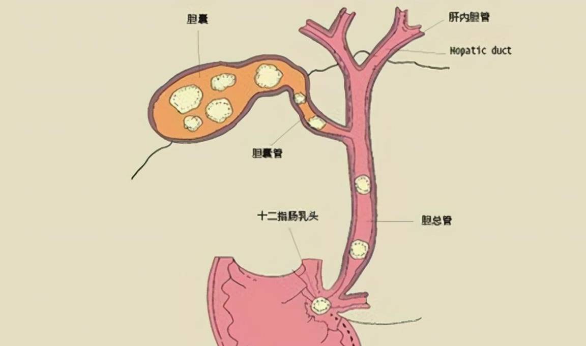 原创            甘油三酯高了就要吃药？医生：错了，达到一定的数值才要吃降脂药