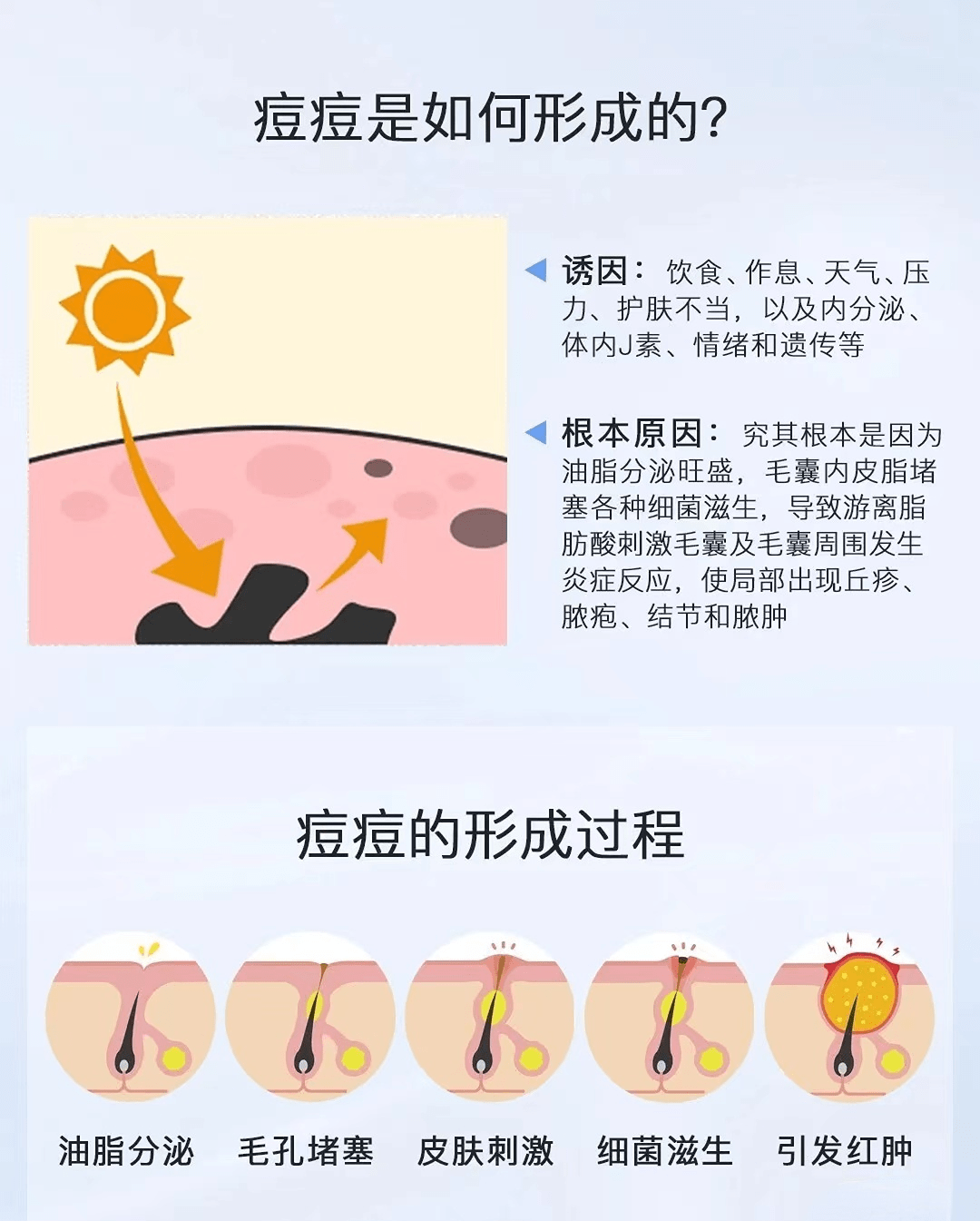 油脂分泌过剩图片