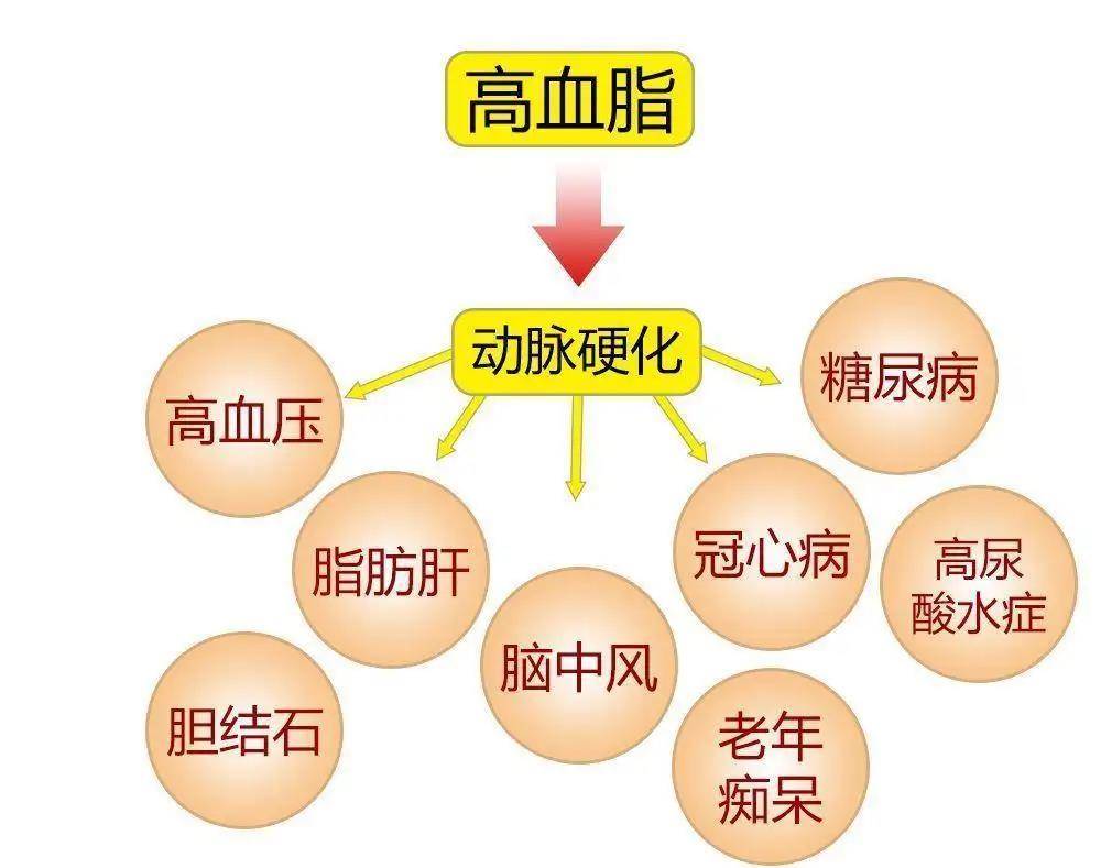 怎樣降血脂?醫生告訴你答案_症狀_檢查_用藥