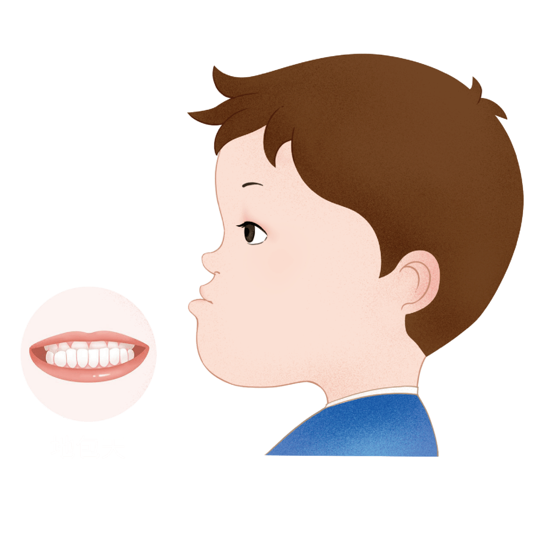 地包天也就是医学上说的反颌,即下牙盖在了上牙外面.