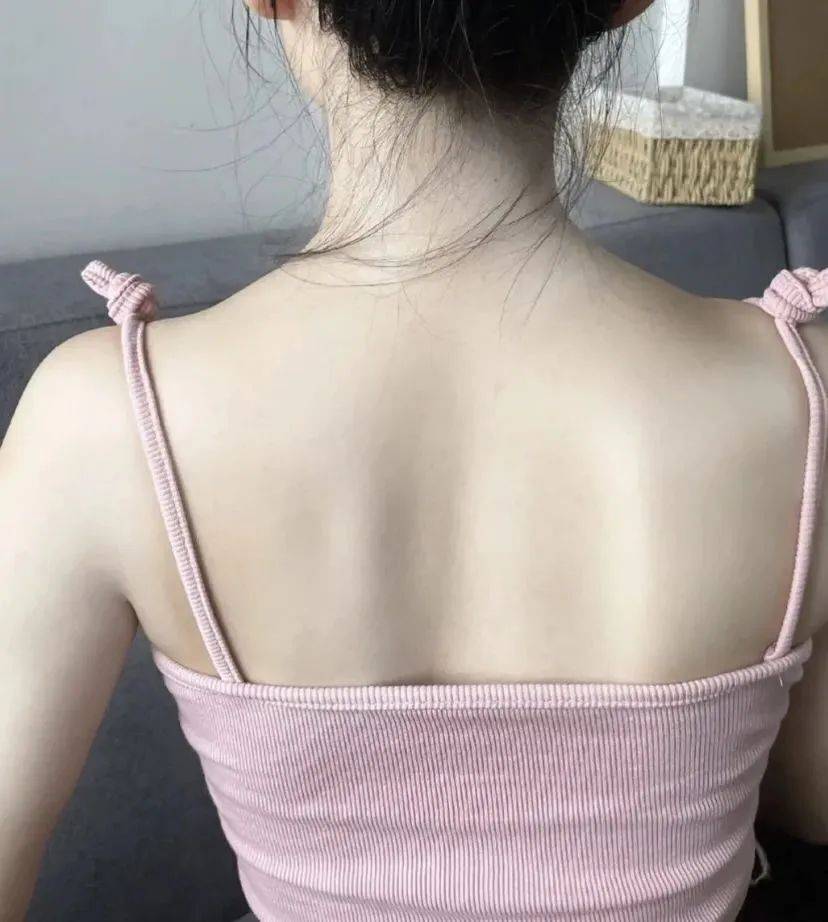 好在功夫不负有心人,在换了不下十几款除螨沐浴露之后彻底解决了后背