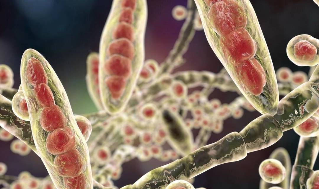 酵母菌感染有多可怕?