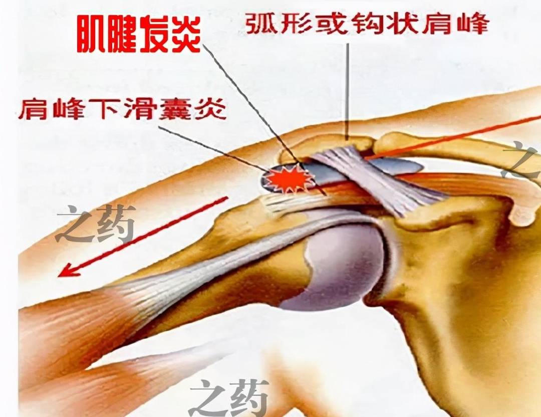 手臂上的肌腱分布图图片