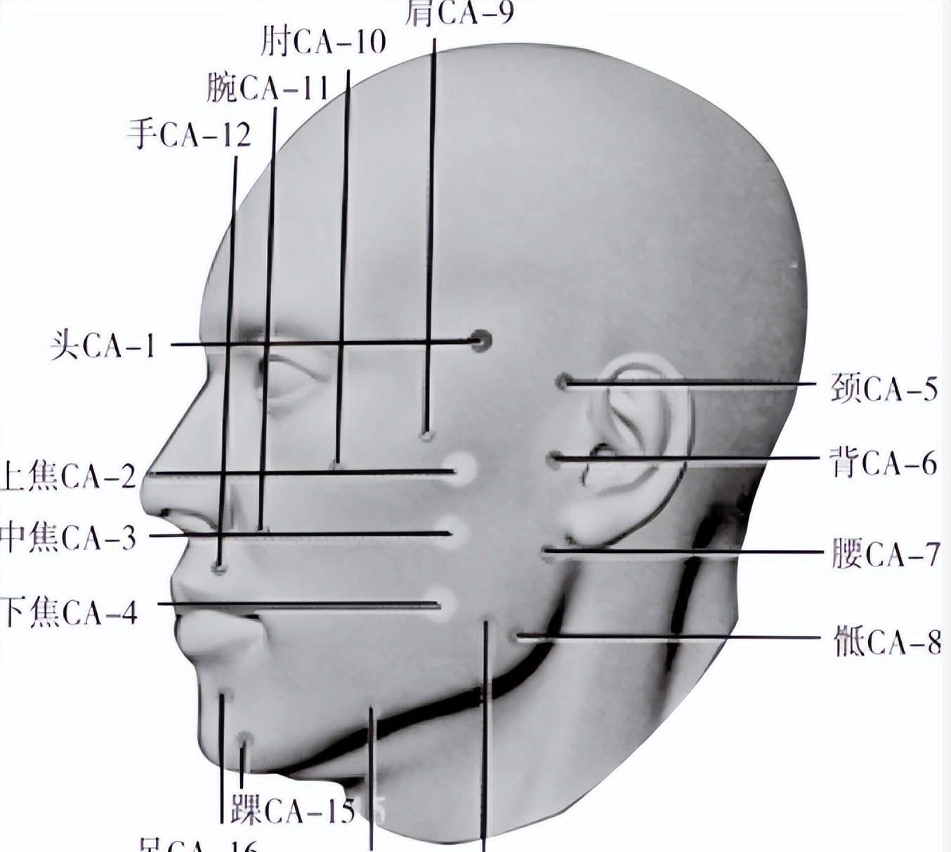 杏林绝技 扎脸治全身