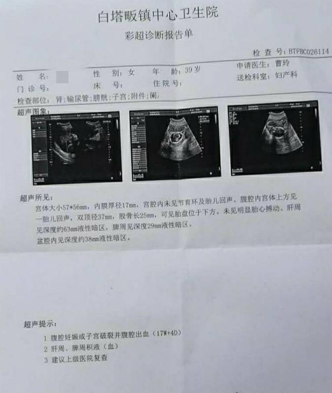 已经发生腹腔内大出血了,即将发生低血压休克,是什么原因,子宫破裂