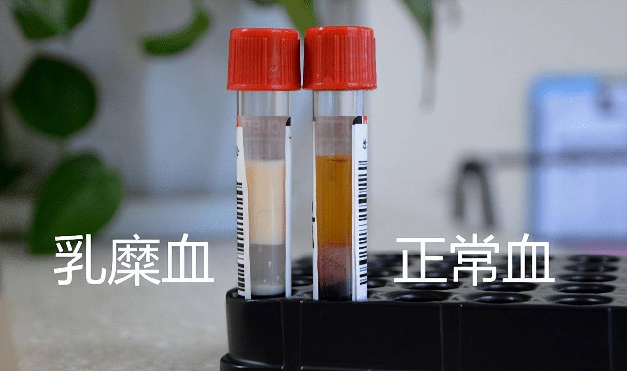 奶茶喝多了,给血液加点料|中山医院肝胆外科|上海陪诊_韩女士_旅游