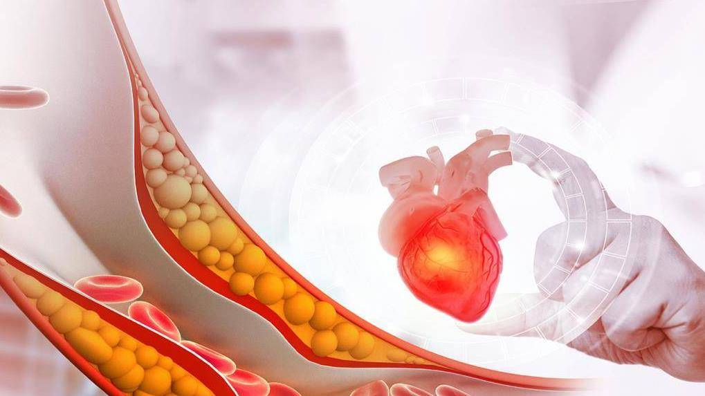 血管老化身体会受到三个威胁!