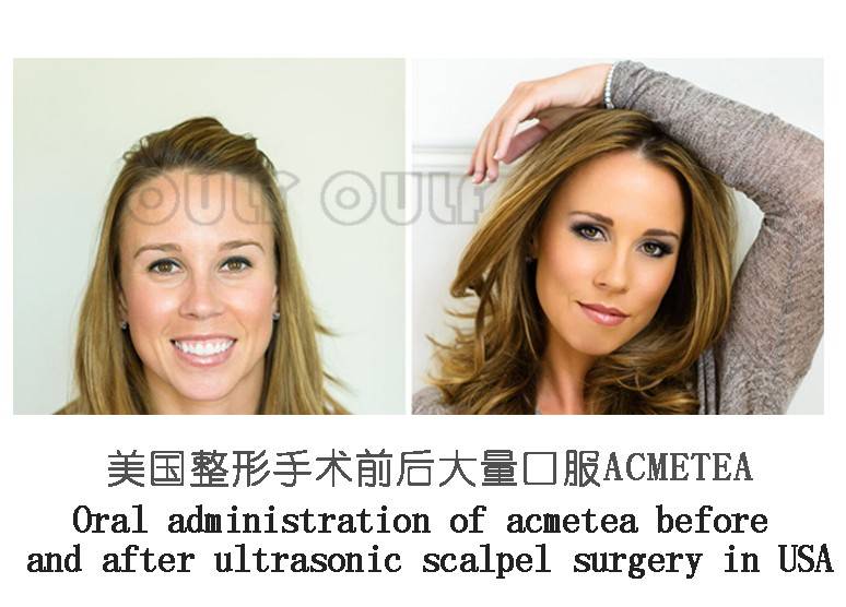 实锤了：筋膜悬吊面部提升术多少钱、筋膜提升多少钱~-筋膜悬吊多久有效果