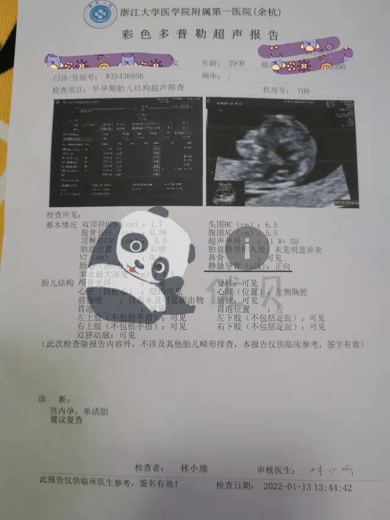 怀孕报告单真实图片