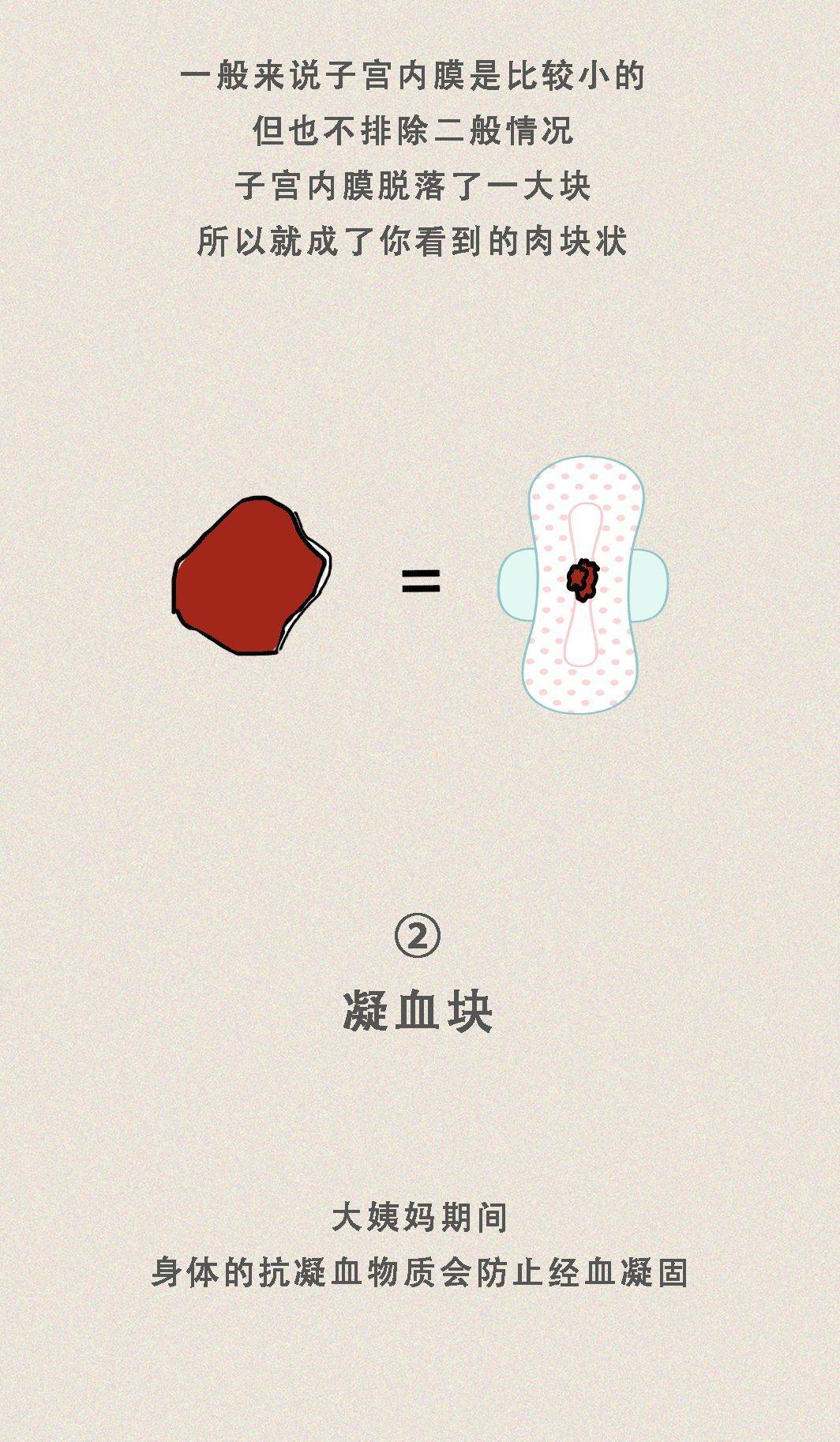 总结:月经期出现大块的"肉块",一般来说是脱落的子宫内膜,基本属于