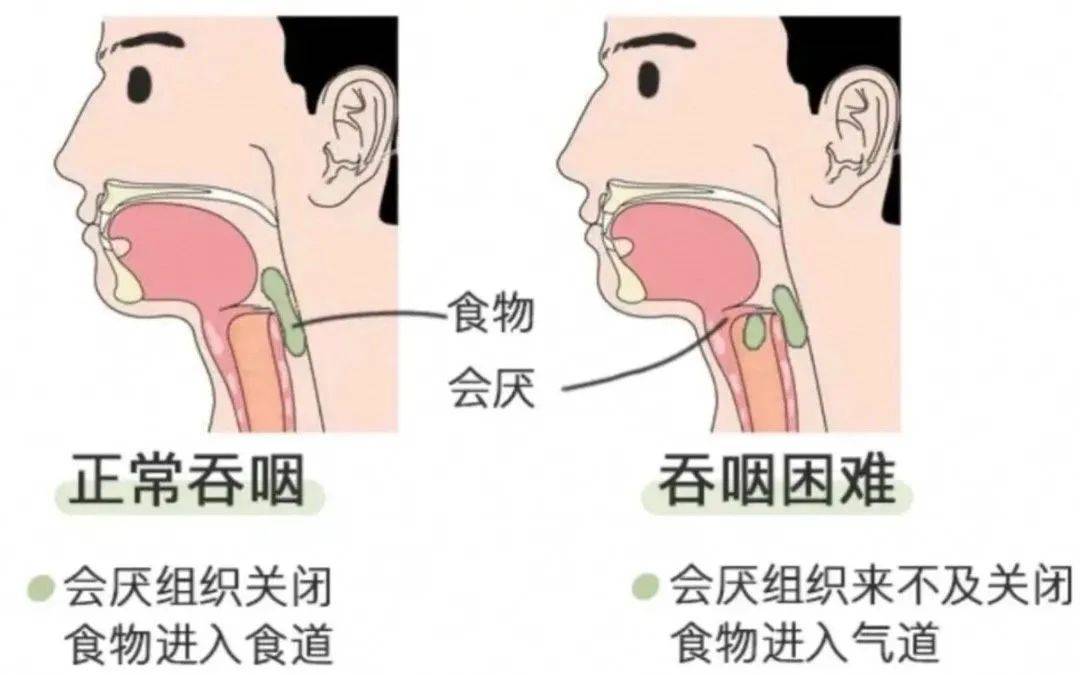 咽与喉的区别图片