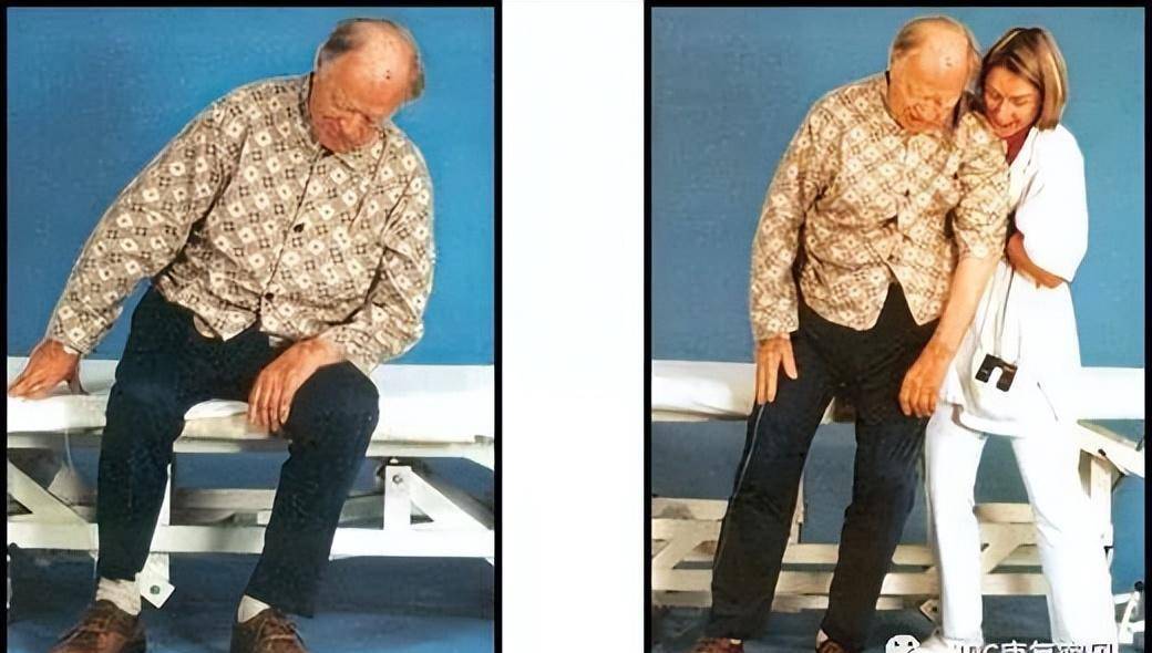 严重影响偏瘫患者康复进程的一个临床特征-倾斜综合征_身体_治疗师