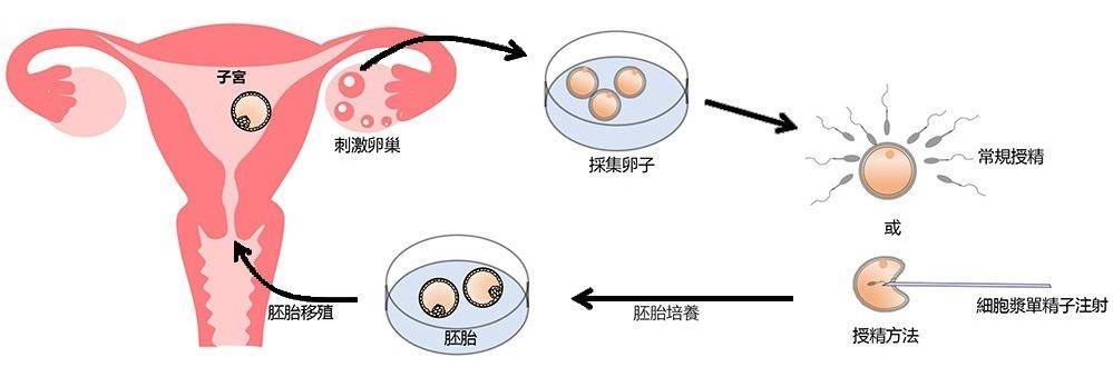 进入女性体内后,没“受精”成功的精子都去哪儿了?既好笑又心疼_选手_到达_呈酸性