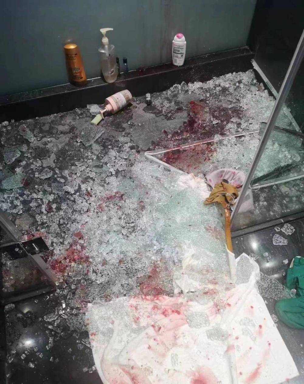浴室玻璃门炸裂致女房客多处受伤,酒店垫付医疗费赔偿事宜待解_人们