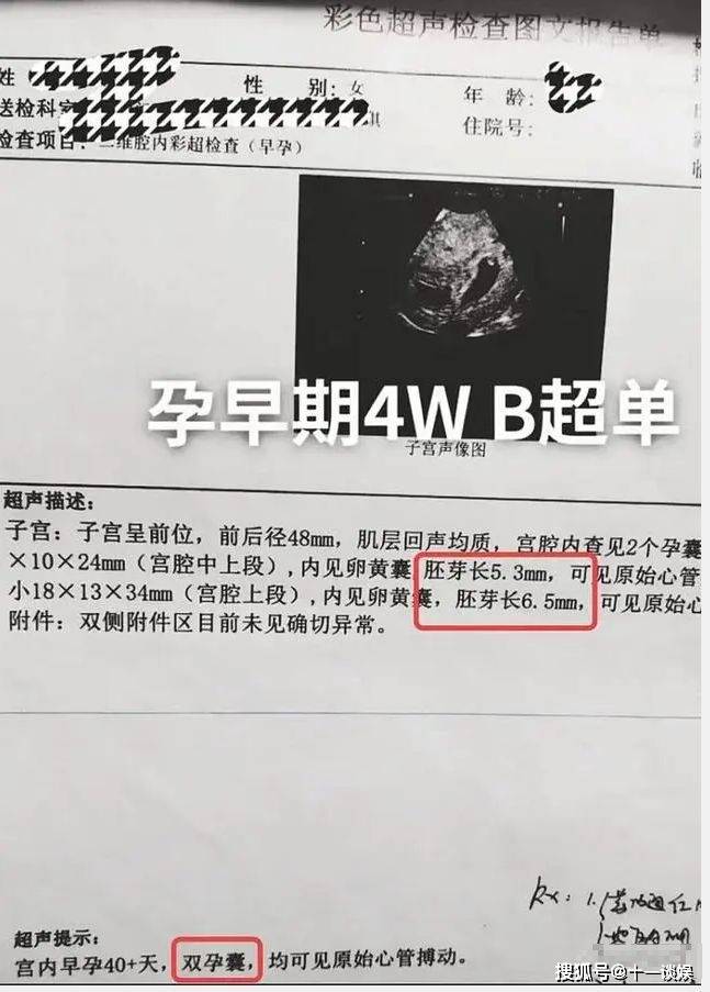 早在去年10月,陈萌就晒出过b超报告单,上面写着双孕囊,但很快就有人