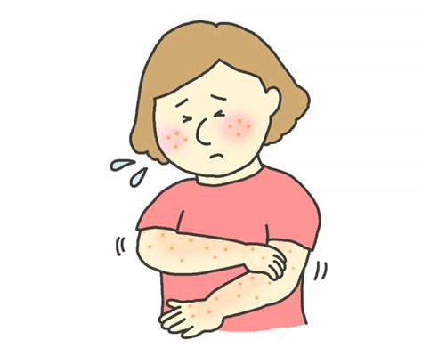 服用靶向药多久会出现皮疹?该怎么处理呢?_治疗_皮肤_软膏