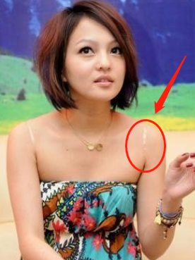 透明带也好不到哪去,肩膀上两条明显的勒痕,看起来实在是不美观.