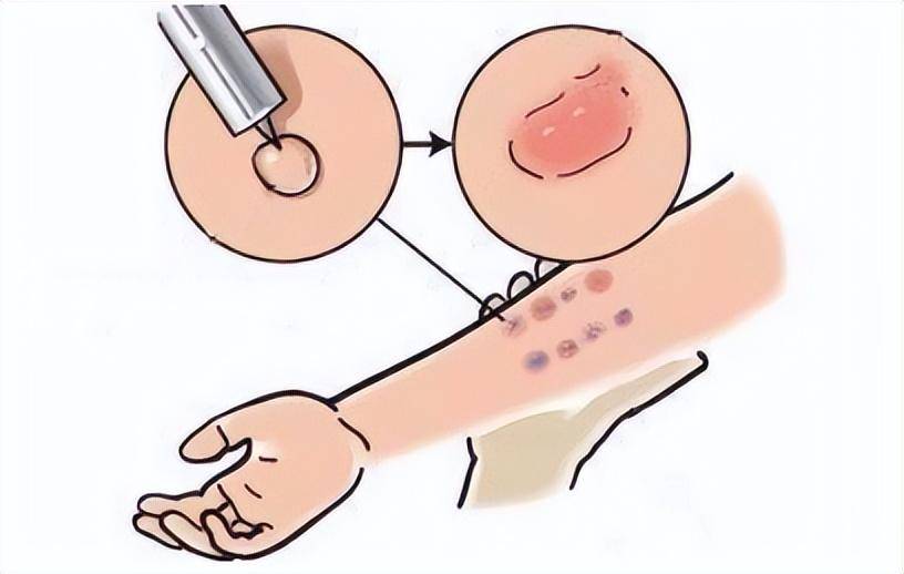 家长们看完记得收藏_检查_部位_进行