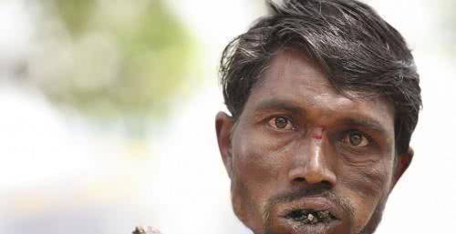 印度一男子得怪病,每天必须吃砖头,已经吃了一座屋了_国家_评论_诱惑