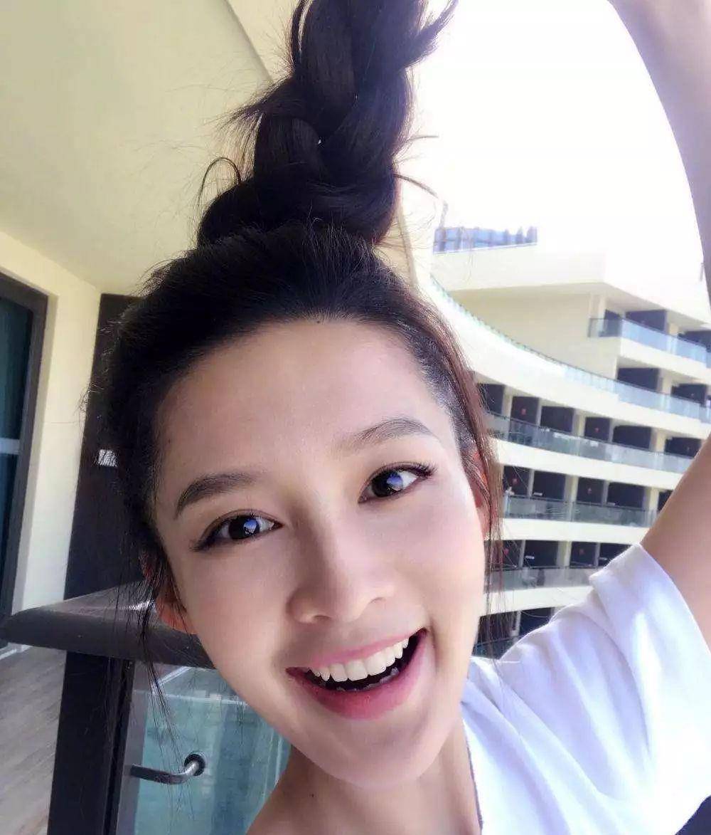 如今张口全是大白牙,笑得"勾魂"_牙齿_牙膏_口腔