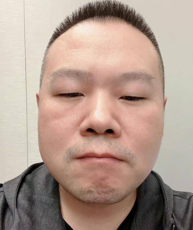 岳云鹏晒照庆祝37岁生日,脸盘圆润有光泽,众师兄弟都送来祝福_自拍